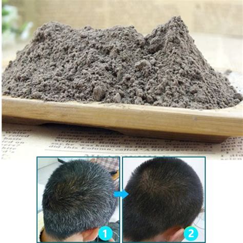 Aliexpress.com : Buy White Hair Turn Black Promote Hair Growth Alopecia ...