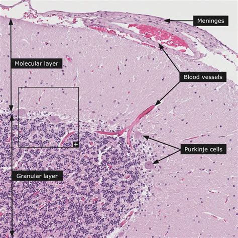 Dictionary - Normal: Cerebellum | Human anatomy and physiology, Medical ...