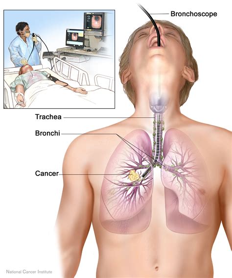 Pulmonary toilet - wikidoc