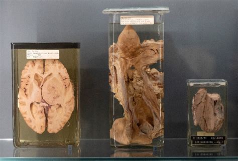 Vienna exhibition tests ethics of displaying human remains