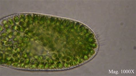 Paramecium busaria under the microscope - YouTube