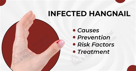 Infected Hangnail: Causes, Prevention, Risk Factors, and Treatment