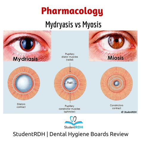 Iris radial muscles in 2020 | Pharmacology, Dental hygiene, Muscle