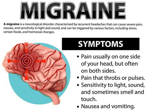 Migraines Unraveled: Causes, Symptoms, and Treatment