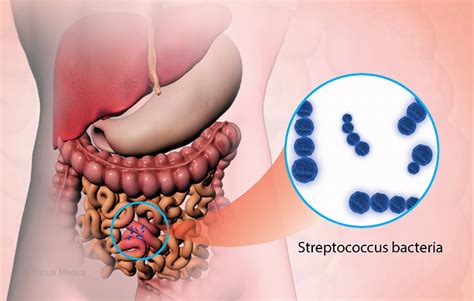 Health Condition : Symptoms, Causes, Treatment and More