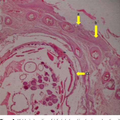 Figure 5 from Pathological lesions associated with Cordylobia anthropophaga infestations of dogs ...