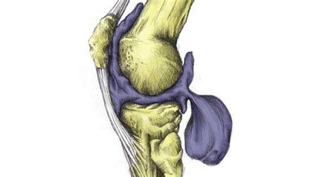 Baker's Cyst Anatomy