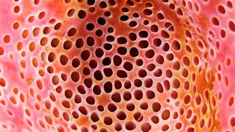 The definition of trypophobia is ..small holes..fear..at anyrate ...you ...