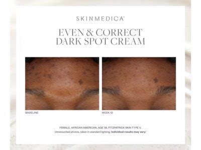 SkinMedica Even & Correct Treatment Pads - On Sale! Order Now.