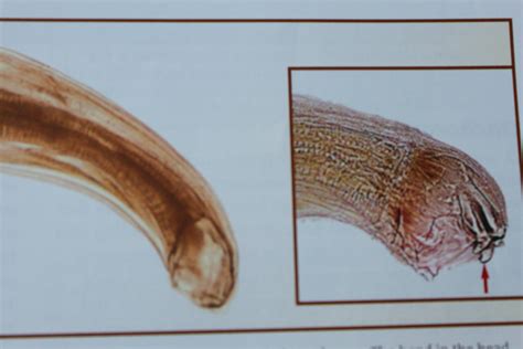 Hookworms in humans poop - psawecurrent