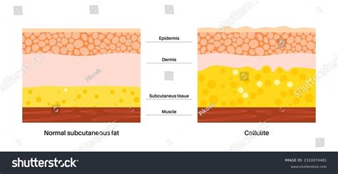 1,620 Skin Layers Muscle Images, Stock Photos, 3D objects, & Vectors | Shutterstock