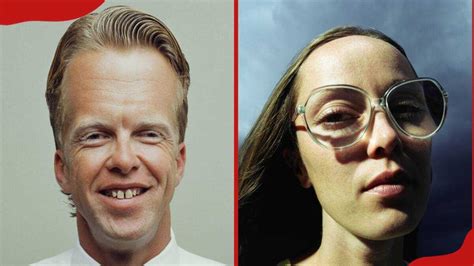 Who has the biggest forehead in the world? (With pictures) - Tuko.co.ke