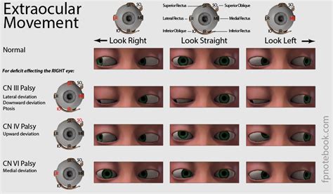 Oren Gottfried, MD on Twitter: "Eyes movement neuro exam"