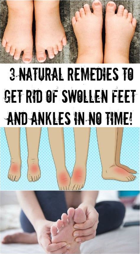 3 NATURAL REMEDIES TO GET RID OF SWOLLEN FEET AND ANKLES IN NO TIME! | Swollen ankles, Natural ...
