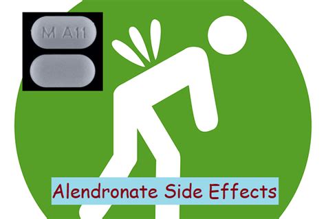 15 Alendronate Side Effects, Usage, And How To Use It » 2022