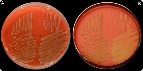 Xét nghiệm tìm vi khuẩn Streptococcus suis (liên cầu lợn) giúp bạn phát hiện bệnh sớm để điều ...