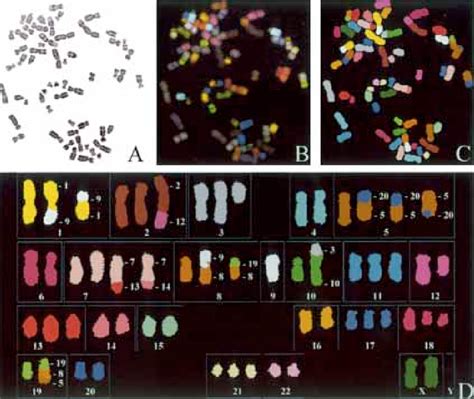 Spectral karyotyping of the human colon cancer cell lines SW480 and ...