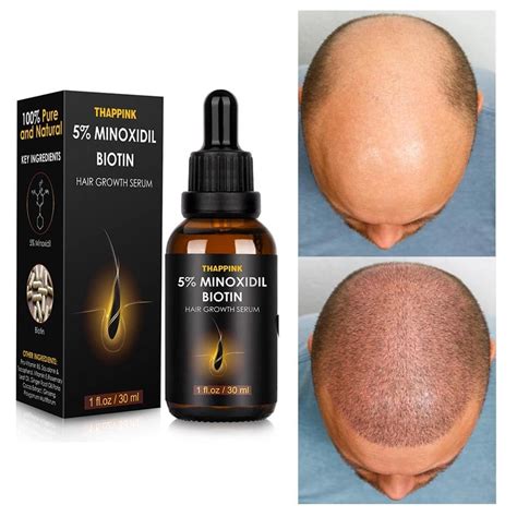 5% Minoxidil Extreme Hair Growth – HairyAgain