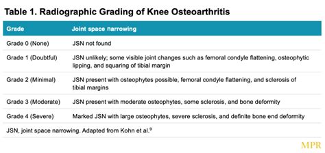 Osteoarthritis - MPR