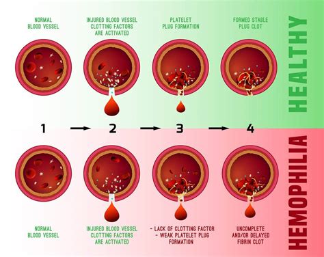 Hemophilia in Cats - Cat-World