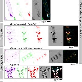 Imaging observations of diazotrophs in Tara Oceans samples Images were ...