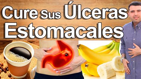 Cure Su Gastritis - Sintomas De Que Tienes Gastritis o Úlceras Y No Lo ...