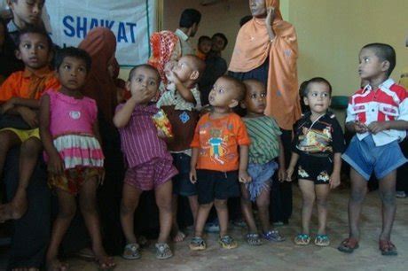 Rickets Treatment for Children in Bangladesh - GlobalGiving