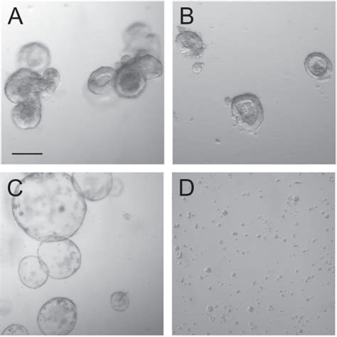 A Protocol for Lentiviral Transduction and Downstream Analysis of ...