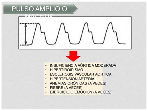 ONDAS DE PULSO