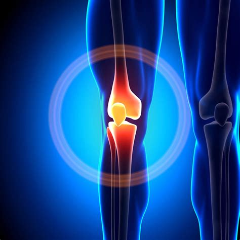 Knee Pain Images