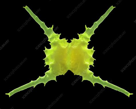 Staurastrum, SEM - Stock Image - C036/0567 - Science Photo Library