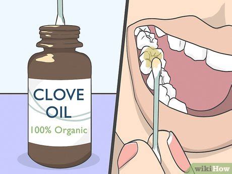 4 Ways to Use Clove Oil for Tooth Pain - wikiHow