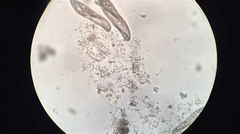 Amoeba Under Microscope 400x Labeled Micropedia | Free Hot Nude Porn Pic Gallery