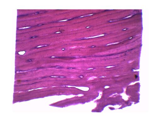 Bone – Cross Section & Longitudinal Section – Prepared Microscope Slide – 75x25mm (EACH) | KLM ...