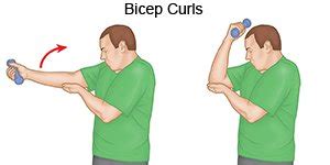 Elbow Bursitis Exercises - What You Need to Know