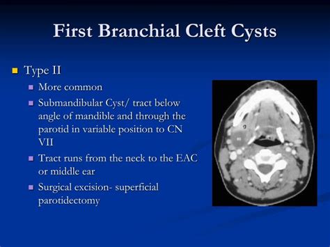 PPT - Head & Neck Masses including Salivary Glands PowerPoint Presentation - ID:2123208