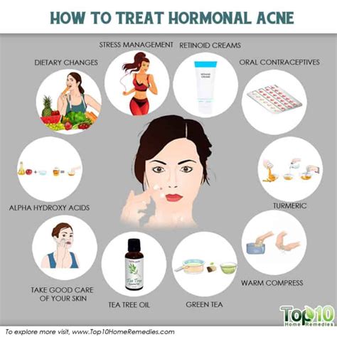 How to Treat Hormonal Acne | Top 10 Home Remedies