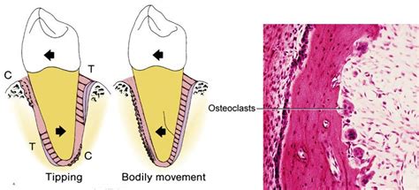 Dentistry lectures for MFDS/MJDF/NBDE/ORE: An Illustrative Note ...