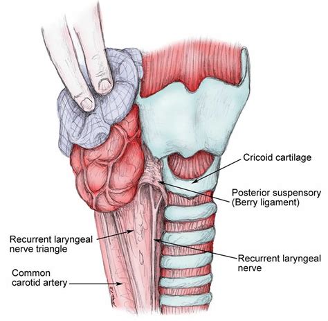 Cricopharyngeal myotomy indications, procedure, complications, recovery ...