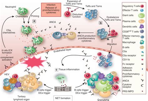 New pathophysiological insights and treatment of ANCA-associated vasculitis - Kidney International