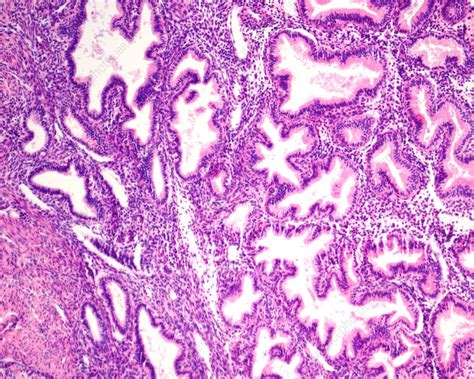 Histology Of The Human Endometrium During The Normal Cycle