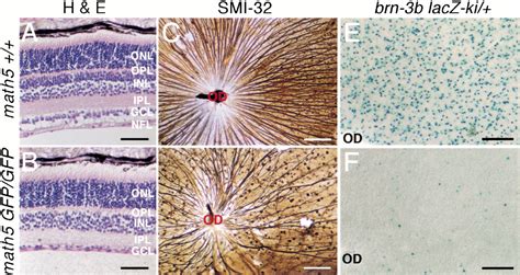 Requirement for math5 in the development of retinal ganglion cells