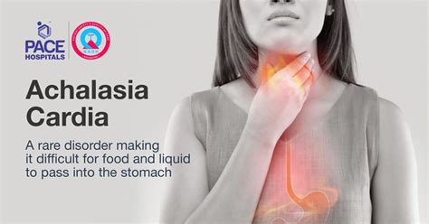 Achalasia Cardia: Symptoms, Diagnosis and Treatment