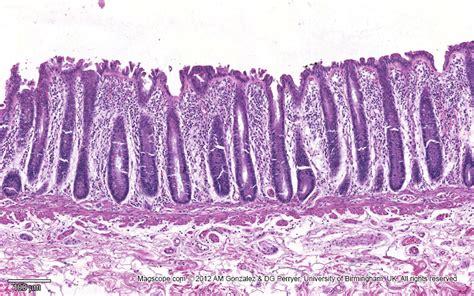 Colon Mucosa Histology