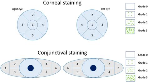 The NEI grading for corneal and conjunctival staining of the ocular... | Download Scientific Diagram