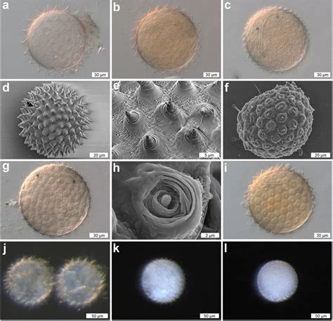 DIC, SEM, and stereoscopic microscope images of the eggs of... | Download Scientific Diagram