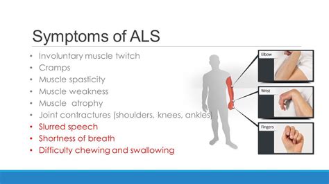 Symptoms of #AlS | Muscle twitching, Muscle atrophy, Muscle weakness