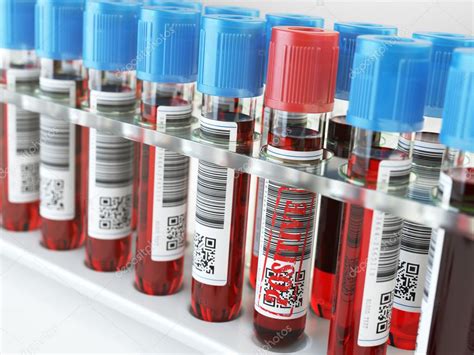 Blood sample positive and many others blood test tubes in a rack — Stock Photo © maxxyustas ...