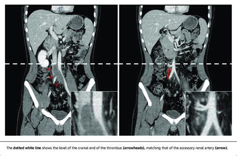 Contrast-Enhanced Computed Tomography | Download Scientific Diagram