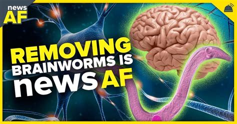 Removing Brain Worms is News AF - August 29, 2023 – RobHasAwebsite.com